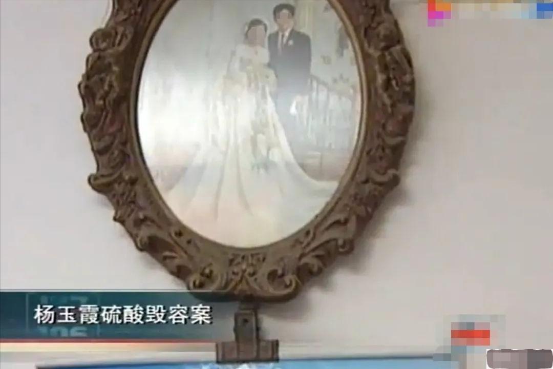 硫酸泼脸自救,硫酸泼到身上怎么自救