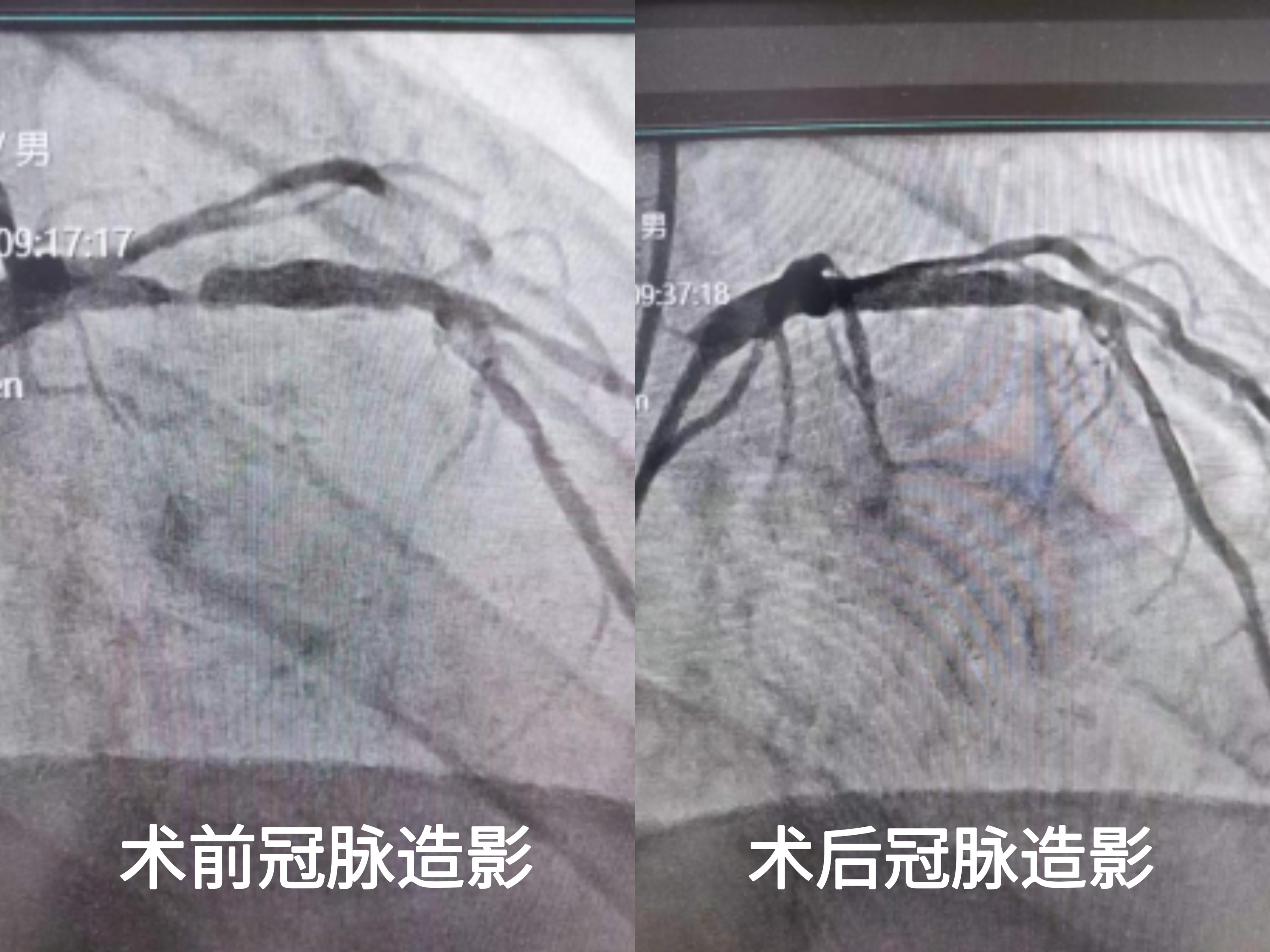 大胆谨“肾”，心肾共赢