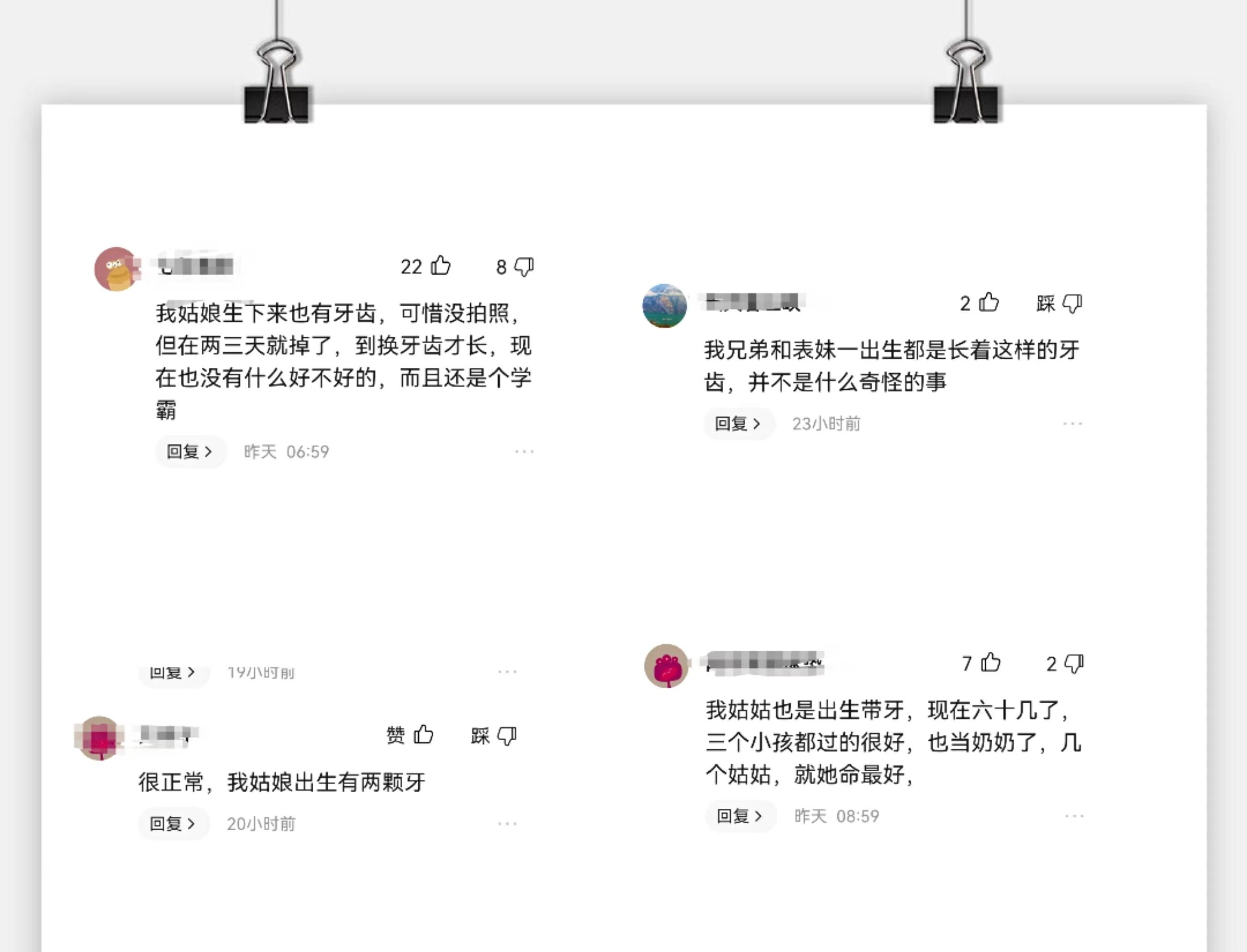 宝宝出生就有牙是什么原因,新生儿鬼牙