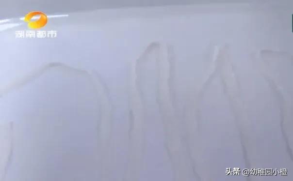 女子体内排出4米长绦虫是什么,宁德女子体内排出4米长绦虫