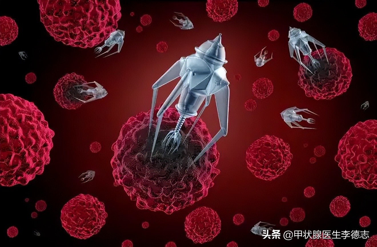 甲状腺癌把甲状腺和淋巴都切除了,甲状腺微小癌淋巴结转移严重吗