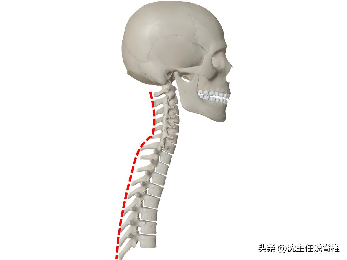 脖子后面与肩膀连接处的富贵包,脖子后面颈椎上的富贵包怎样消除