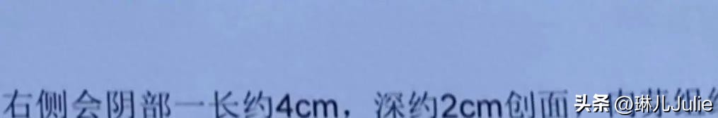 女子被大狗咬伤隐私部位,女子崩溃:留下了疤痕,会对未来有影响