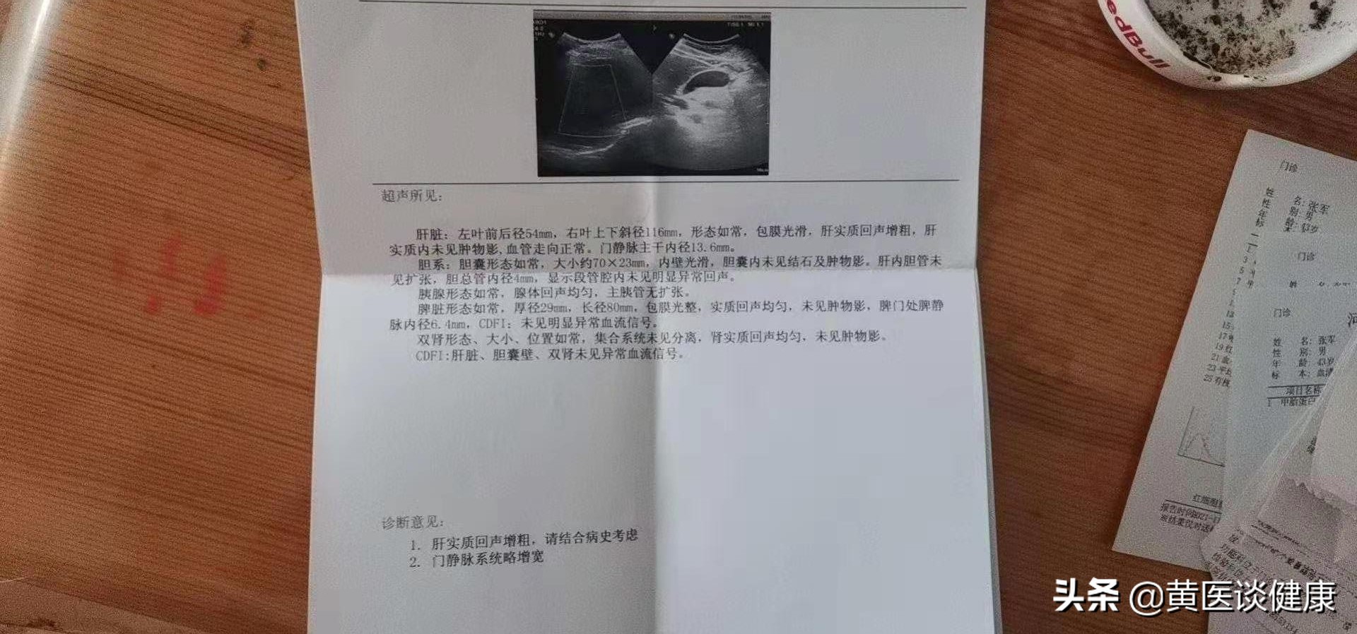 单用干扰素治疗乙肝，表面抗原降至个位数，但无法转阴，怎么办？