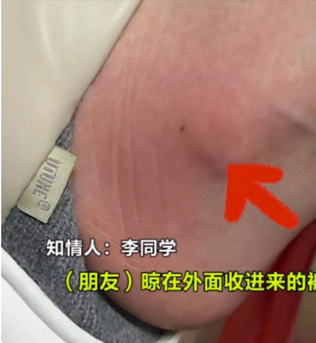 被马蜂蛰的女大学生,隔着裤子被马蜂蛰了