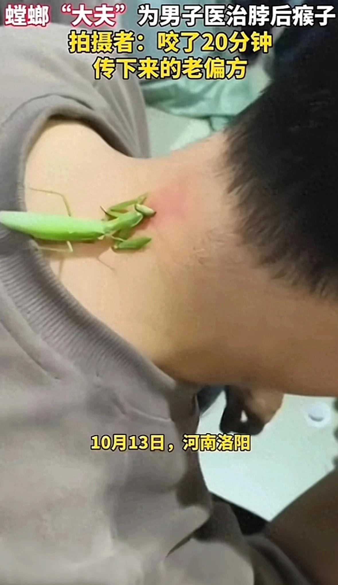 螳螂医治男子脖子后刺瘊,老中医用螳螂治疗脖子上的瘊子