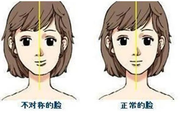 牙齿矫正有几种方式费用怎么算,好的牙齿矫正费用一般要多少钱