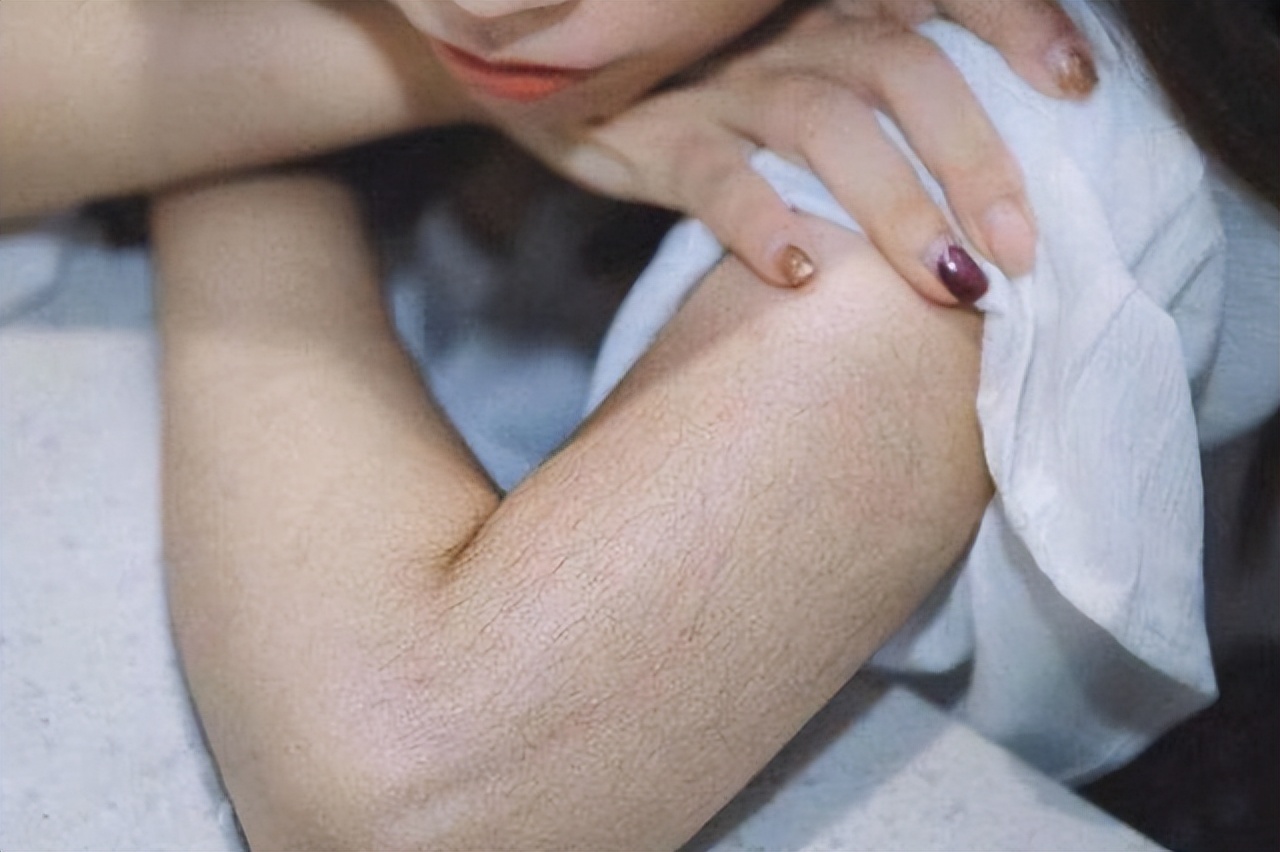 女性怎么有效减少体毛,女性体毛茂盛的原因及治疗方法