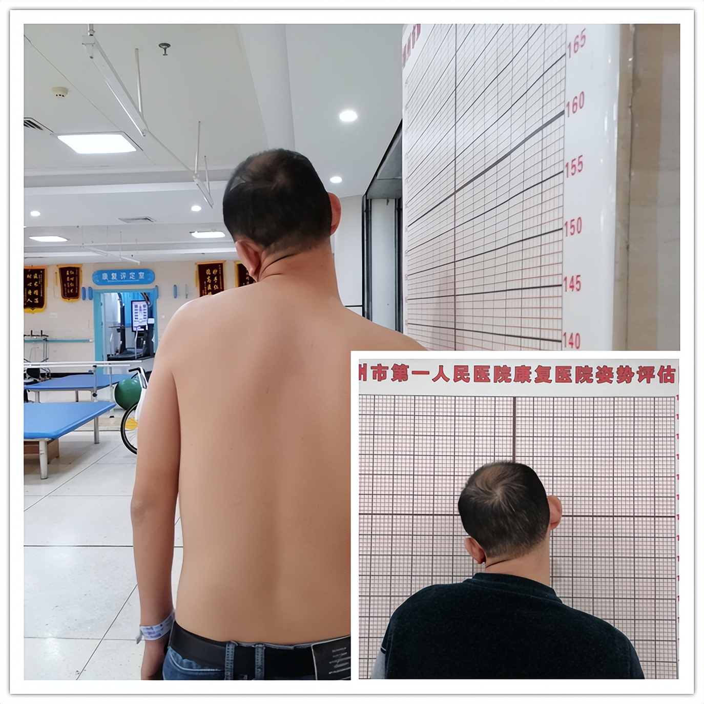 扭脖子的危害有多可怕,随便扭脖子危不危险