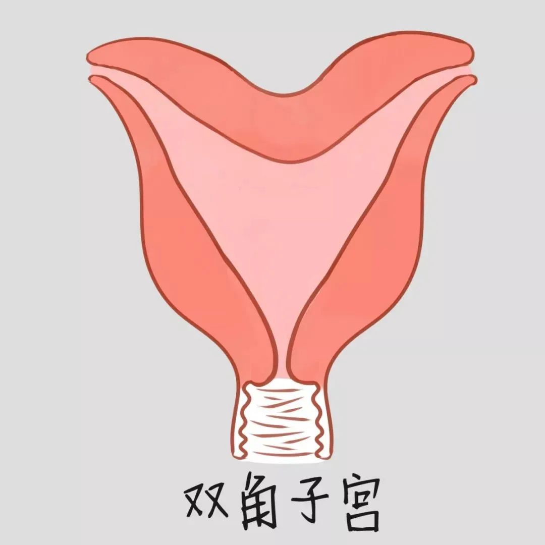 医生，B超提示我有子宫畸形，怎么办？