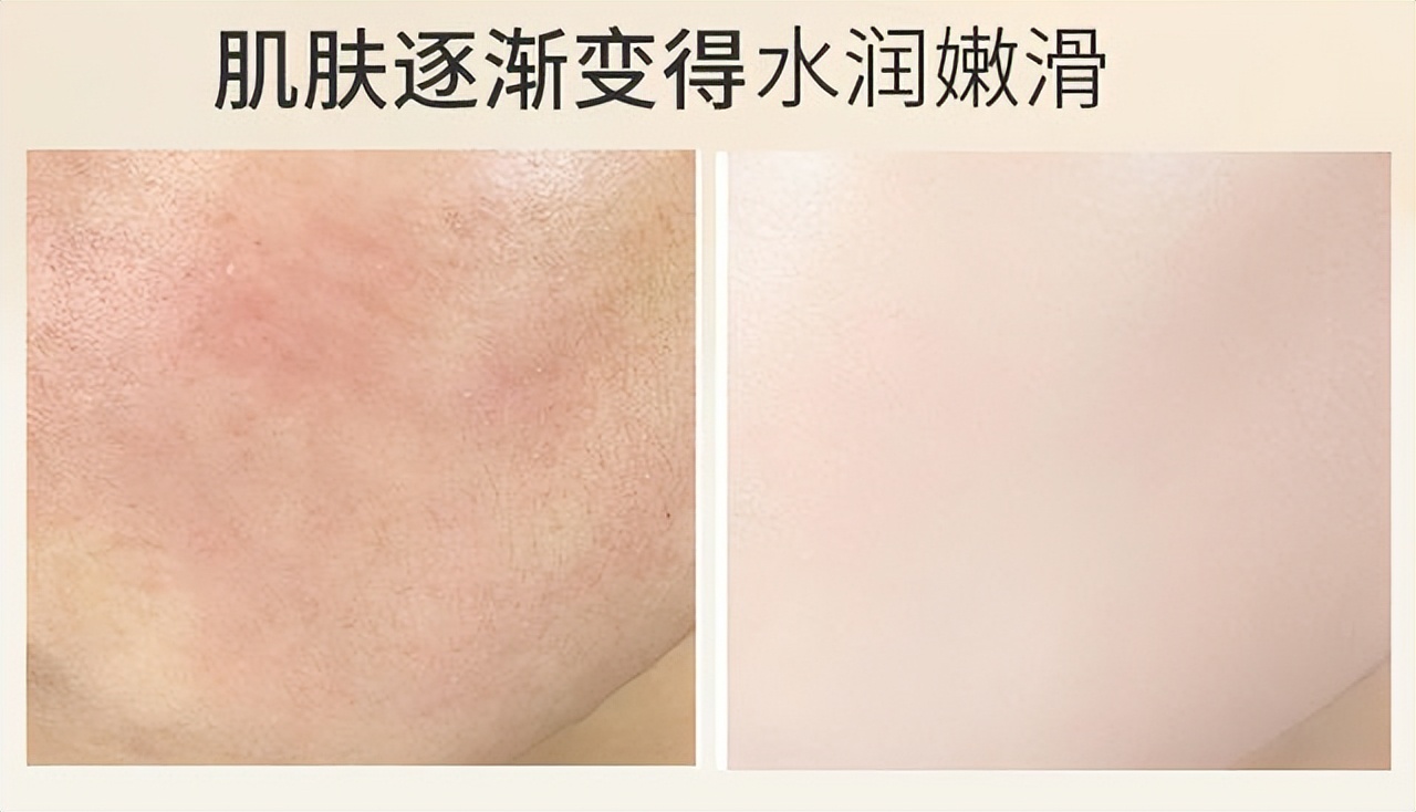 屈臣氏哪个产品祛斑便宜好用,屈臣氏哪个护肤品好用又便宜