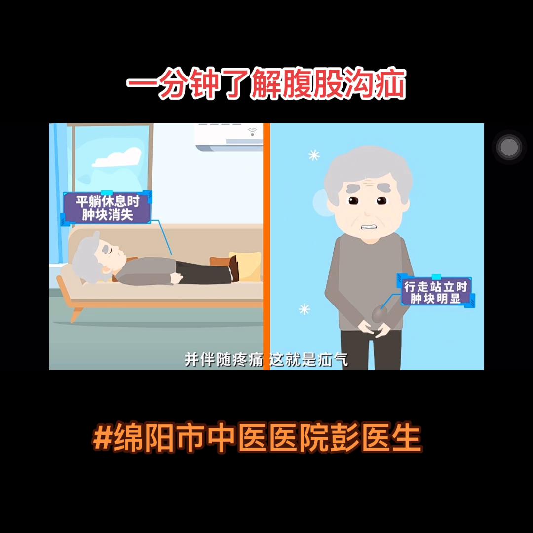 怎样才能改善疝气的形成或预防,一岁才出现的疝气会自己好吗