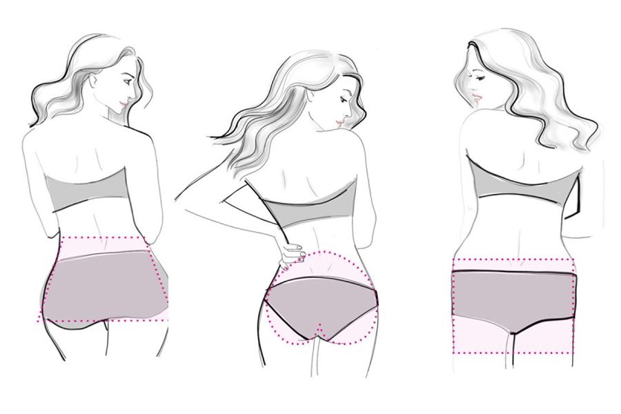 裤子夹屁股怎么回事,裤子夹屁股什么原因