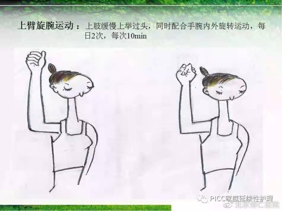 不扎针的输液管,不扎留置针静脉输液