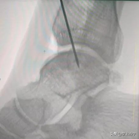 西宁市第三人民医院外科,西宁第三人民医院扩建项目