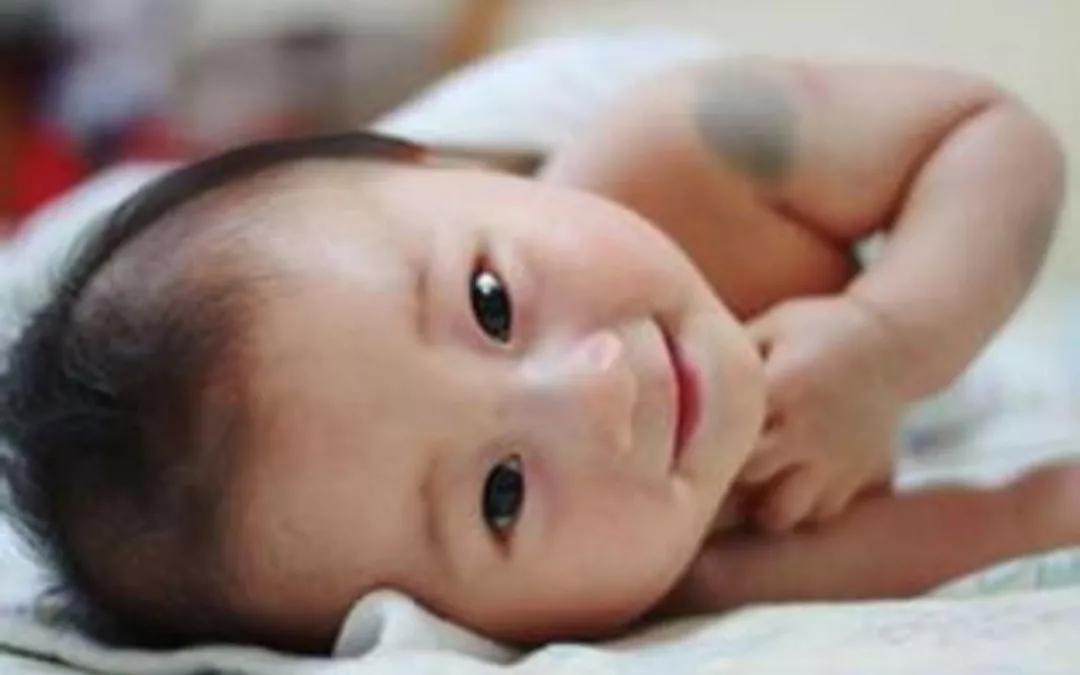 宝宝身上的胎记怎么形成的,怎么避免胎儿长胎记