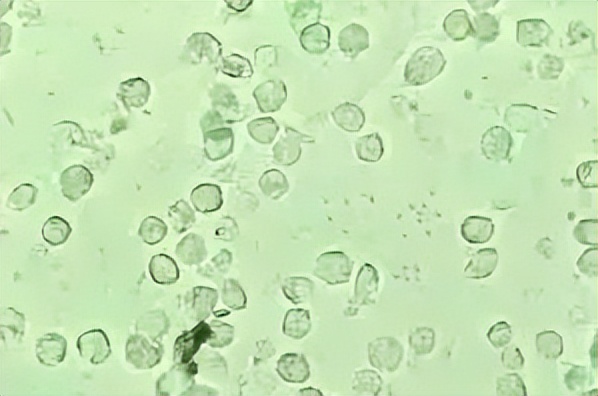 派特灵治妇科病吗,派特灵在妇科怎么使用