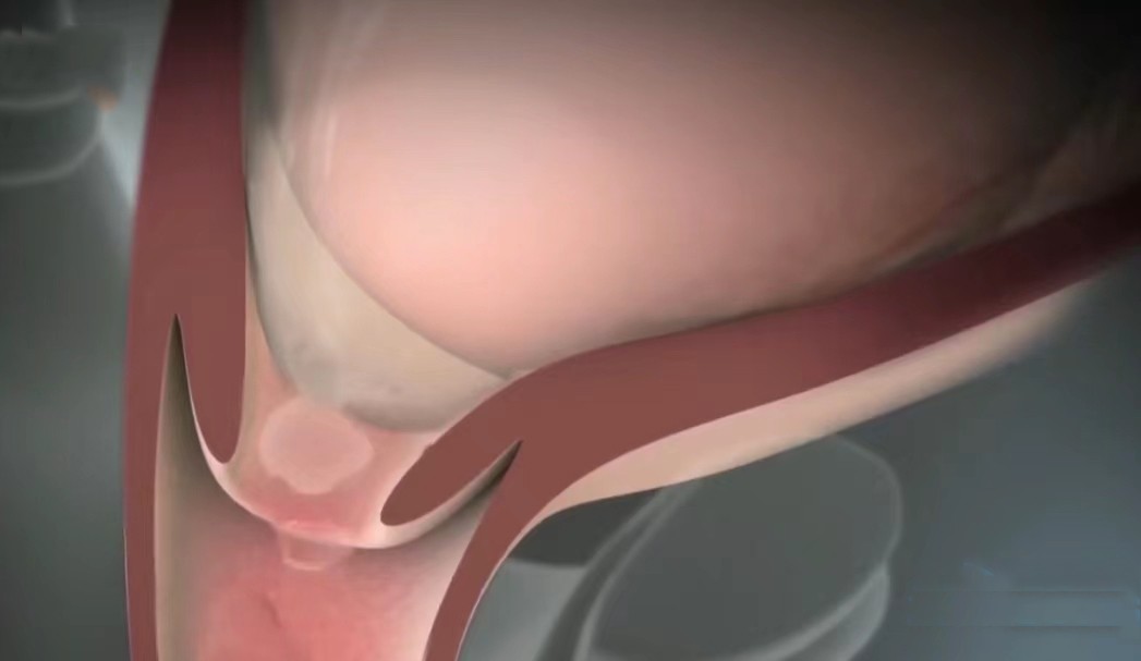 顺产3d动画流程讲解,顺产生孩子母爱伟大