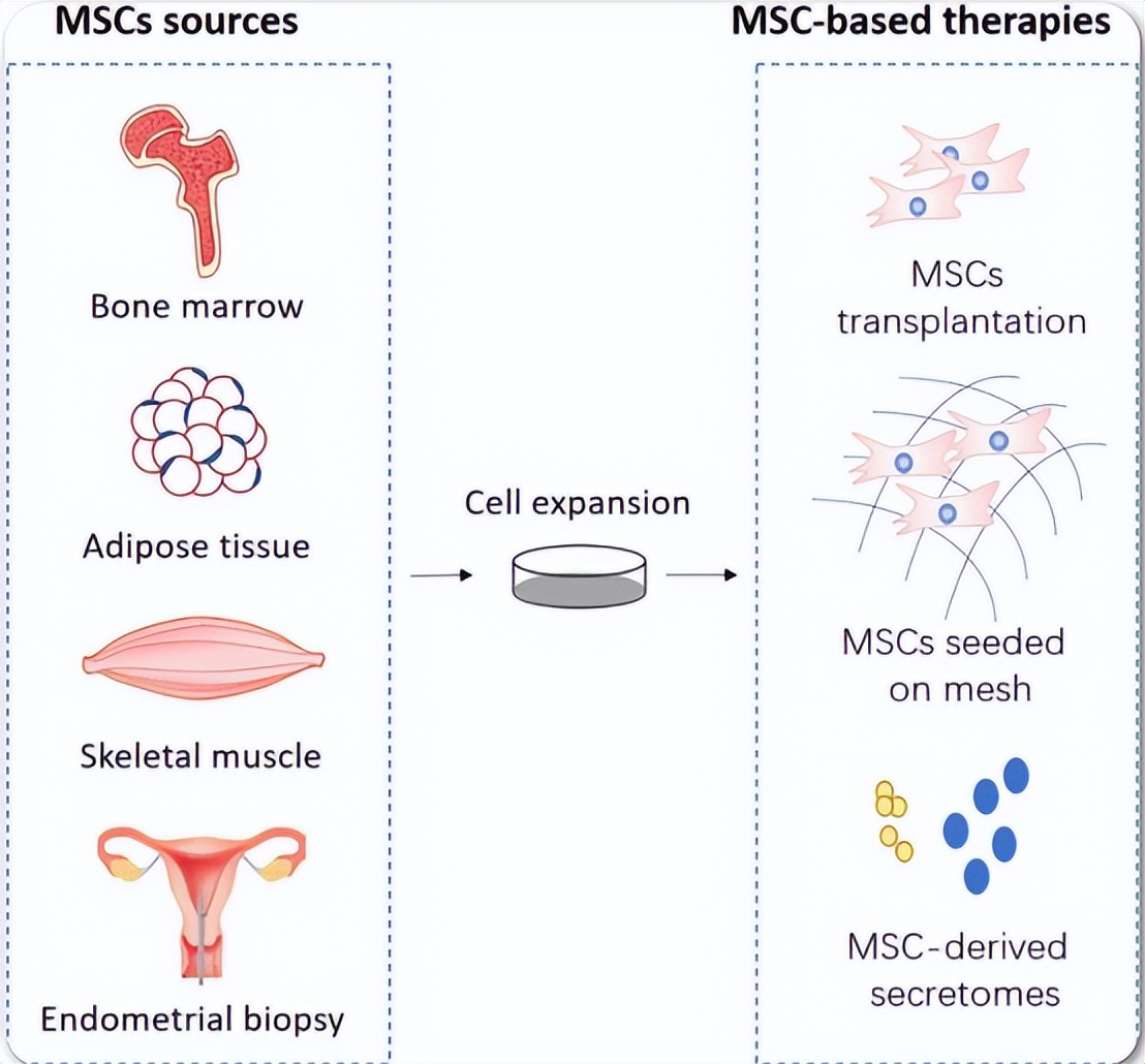 产后盆底肌修复八字实战技巧,干细胞盆底肌治疗哪家医院有