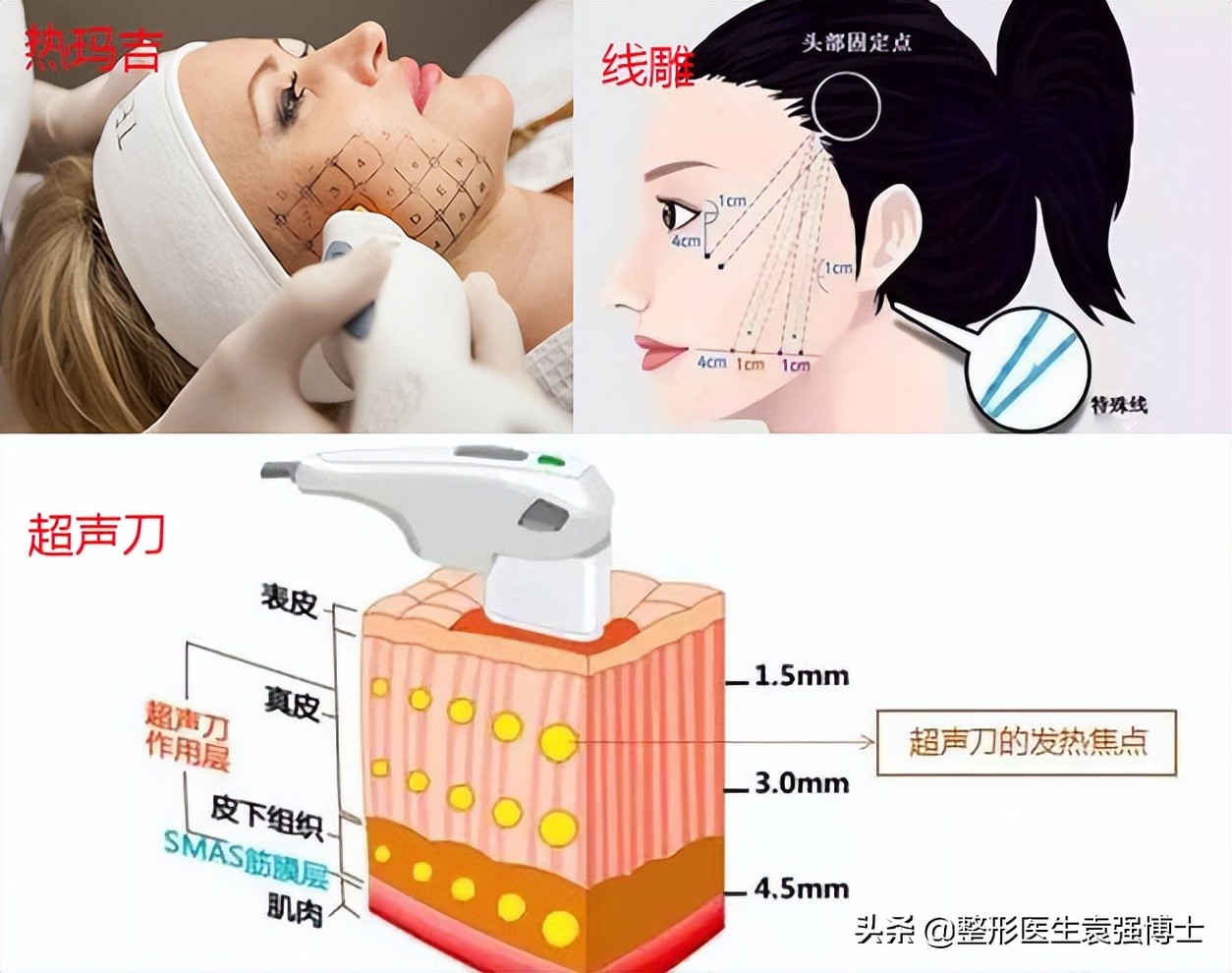 40岁去法令纹最好的方法,40岁就有很深的法令纹