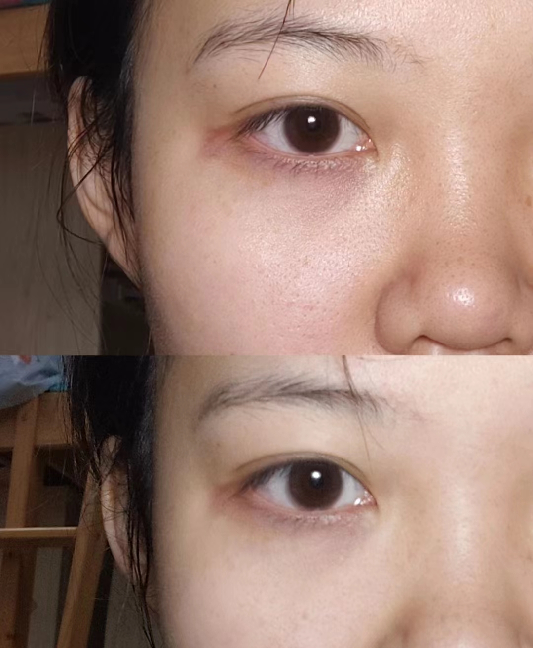 十大公认最好用的面膜品牌,最火的面膜lv