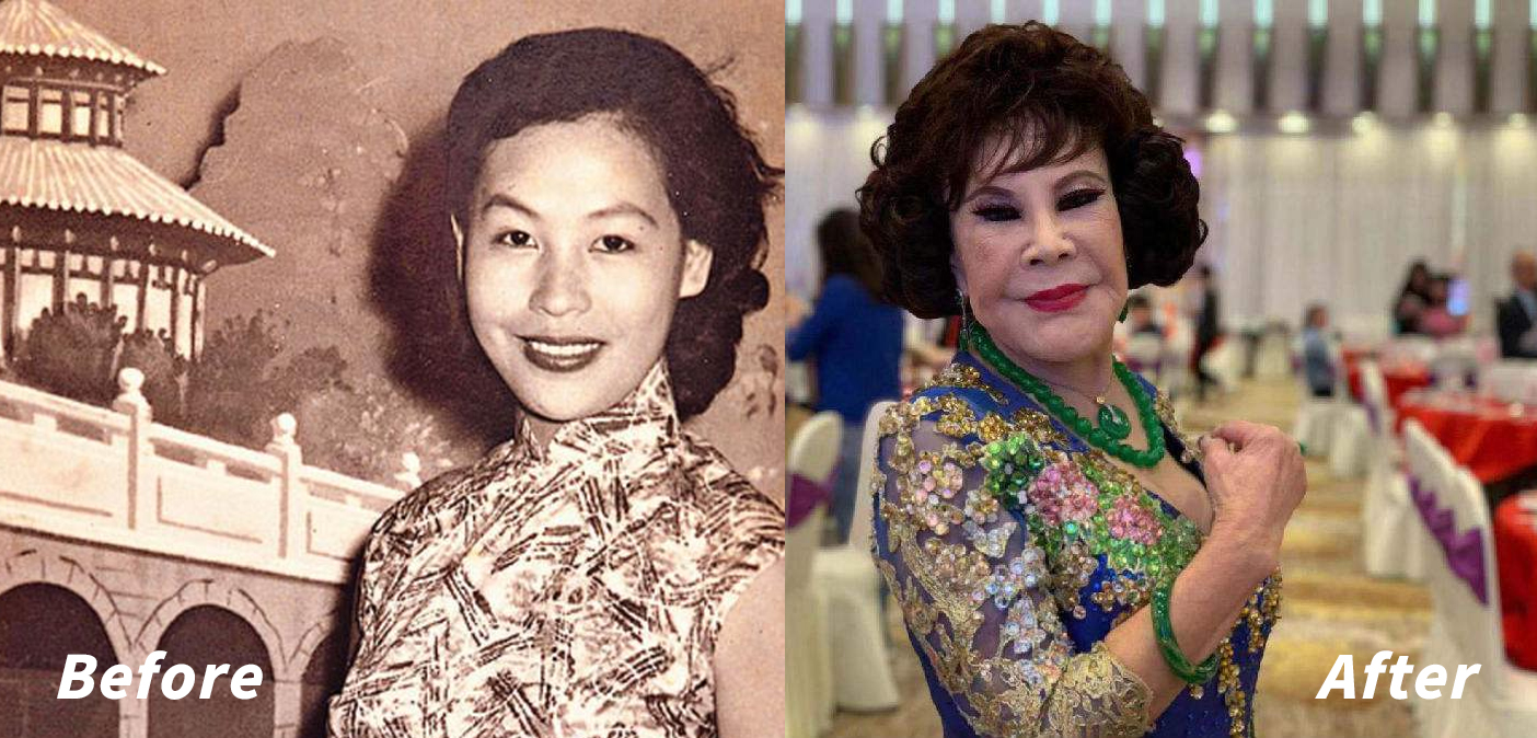 整容毁掉的四位女星,盘点整容失败惨不忍睹的十大女星