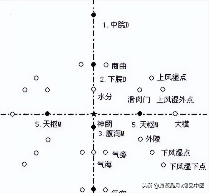 腹针疗法及16例常用处方