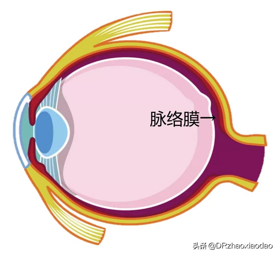 还有人以为脉络膜增厚是坏事吗？看完这篇再说吧