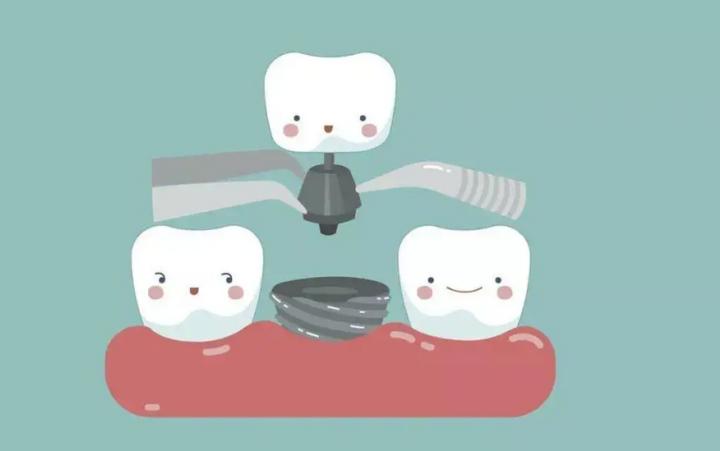 种植牙拔了做矫正,种植牙齿全过程真相大揭秘