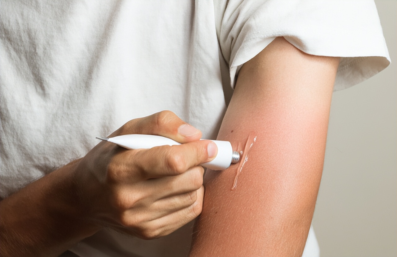 女性出汗引起的胸部痒,胸部老是出汗和痒是什么情况