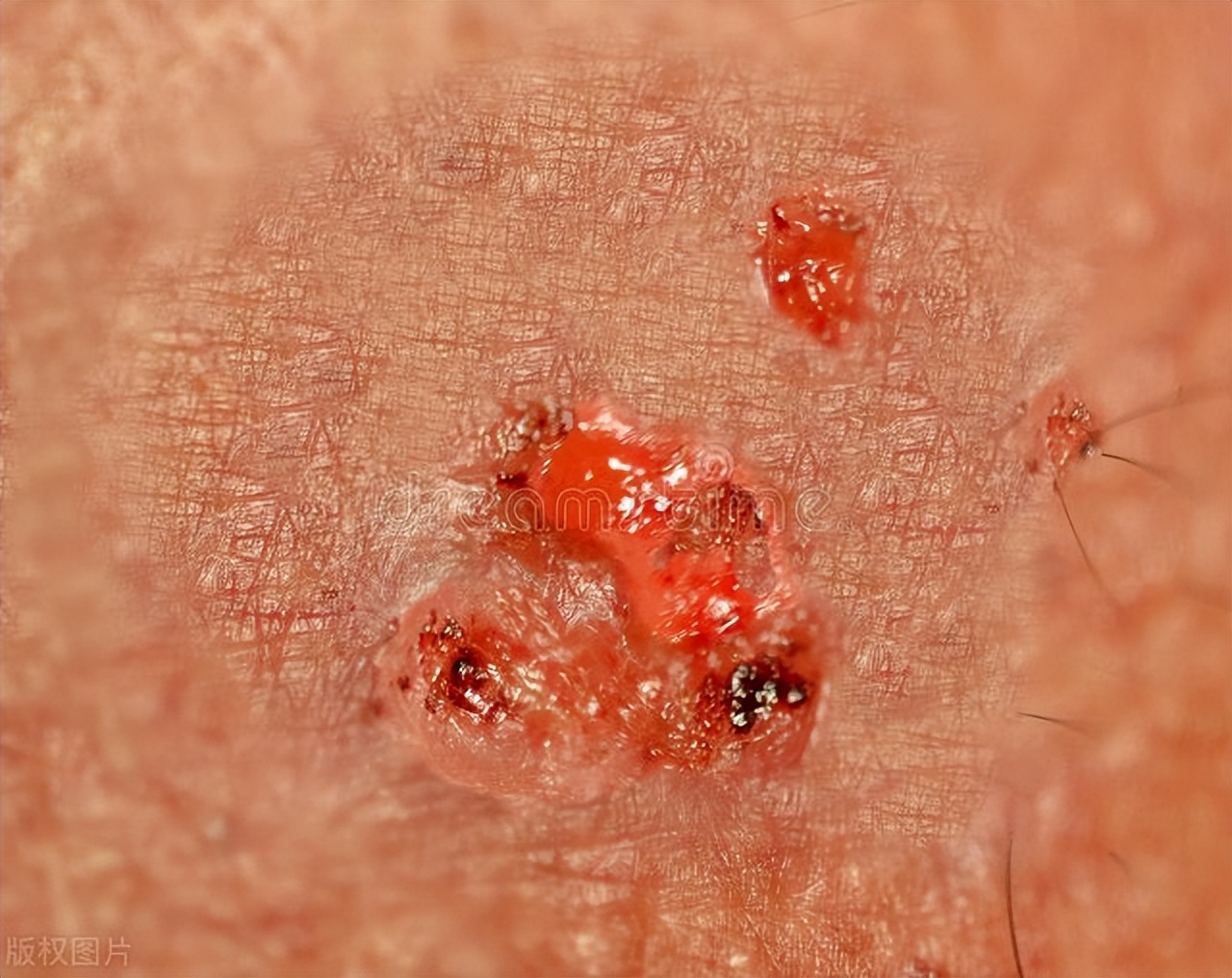 头发直毛卷毛有什么区别,头发大部分是直的里面会有些卷毛