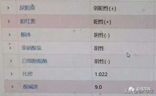 尿常规尿胆红素1+是咋回事,尿液中有胆红素和尿胆原没事吧