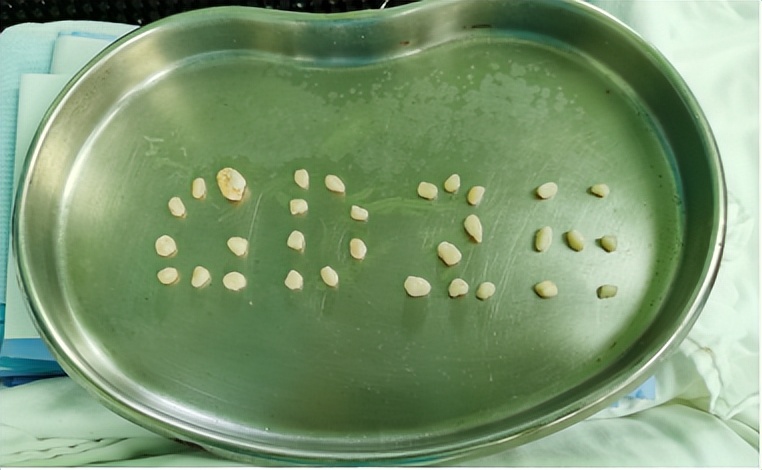 脚踝扭伤的处理方法和康复,脚踝扭伤立即进行的正确处理方法