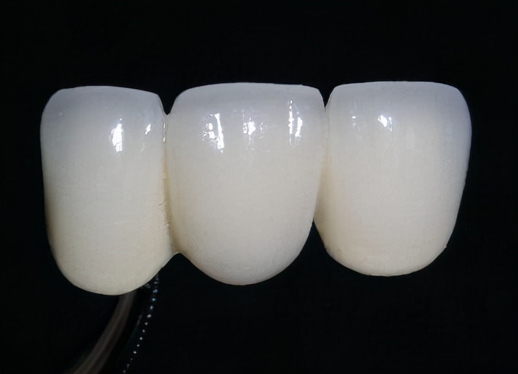做了烤瓷牙后悔了有补救办法吗,都说烤瓷牙不好为什么牙医还推荐