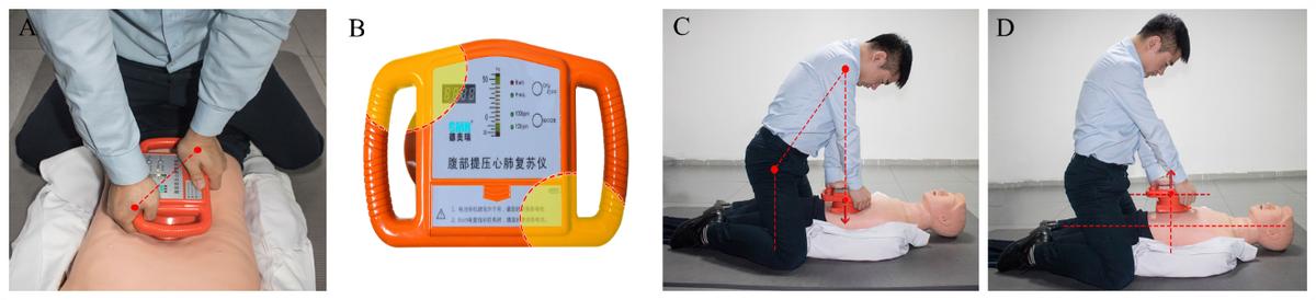 腹部提压心肺复苏术有用吗,腹部提压心肺复苏和胸外心脏按压
