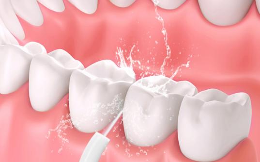 水牙线冲牙器哪个牌子好,平价水牙线冲牙器推荐