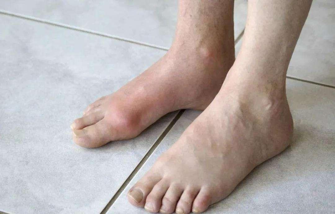 建议不吃这六种鱼有甲醛,三种鱼含甲醛重金属超标切记