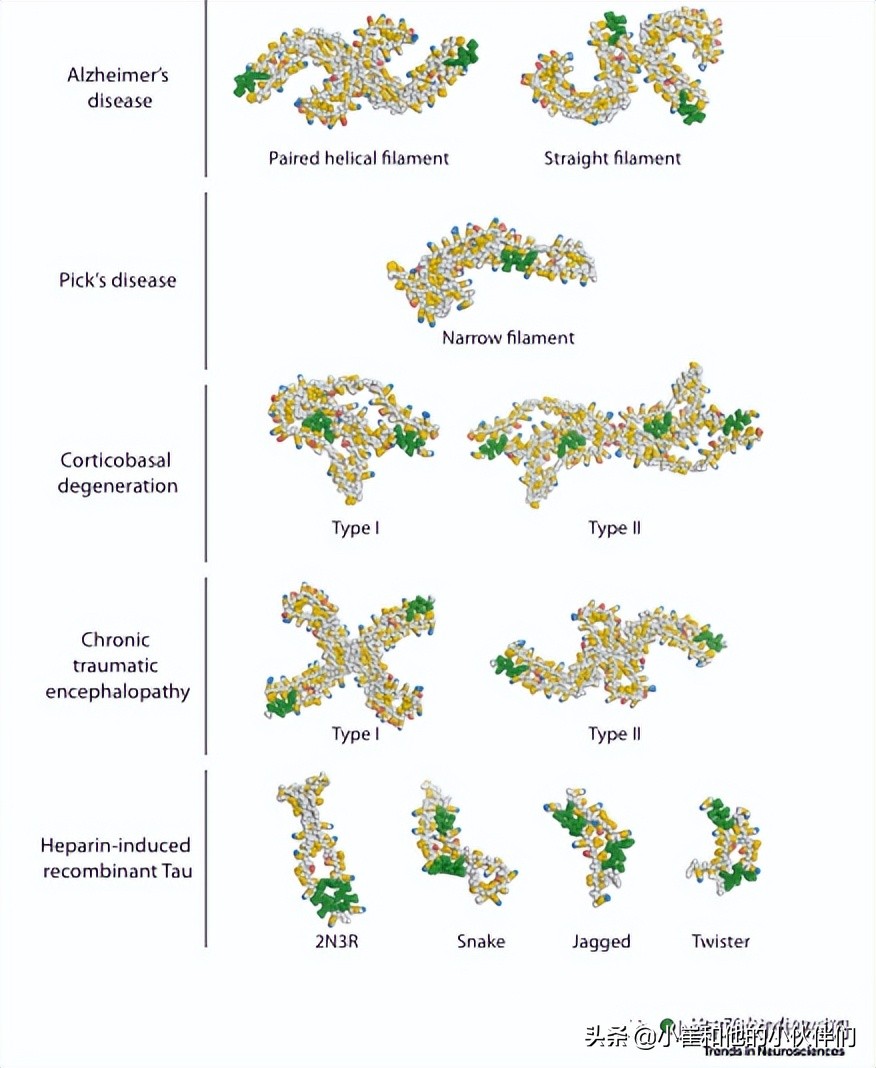 神经退行性疾病研究,神经退行性疾病是什么原因引起的