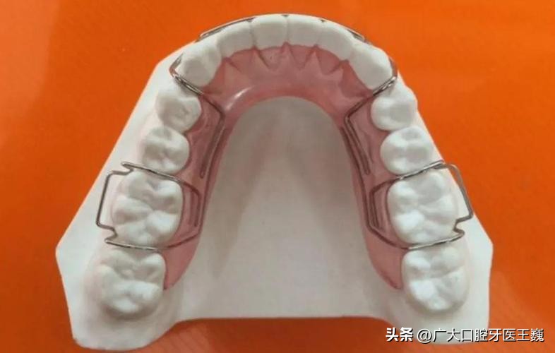 牙齿正畸过程中需要注意什么事项,正畸后要种牙怎么戴正畸保持器