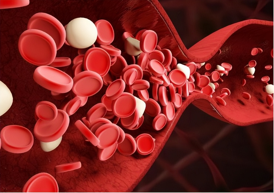 睡觉时腿抽筋是缺钙还是血脂高,睡觉时突然腿抽筋是缺钙导致的吗