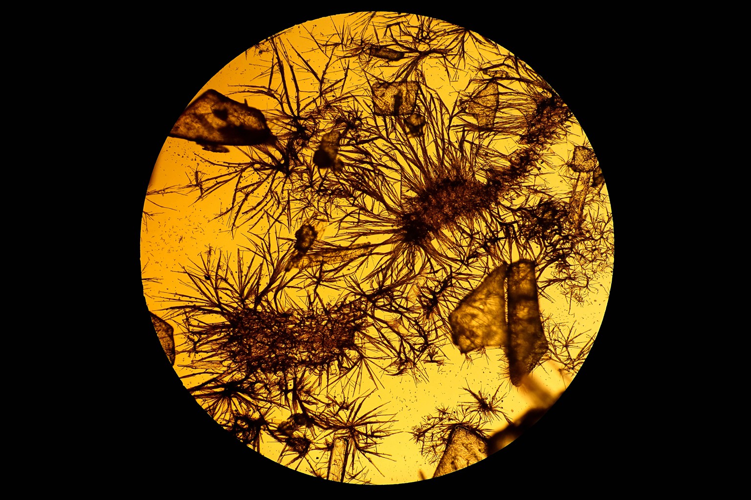 显微镜下结晶图片,显微镜下针状结晶图