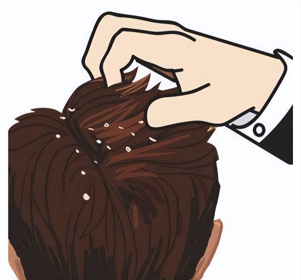 头皮屑太多了怎么处理我教你一招,头皮痒头皮屑多有救了