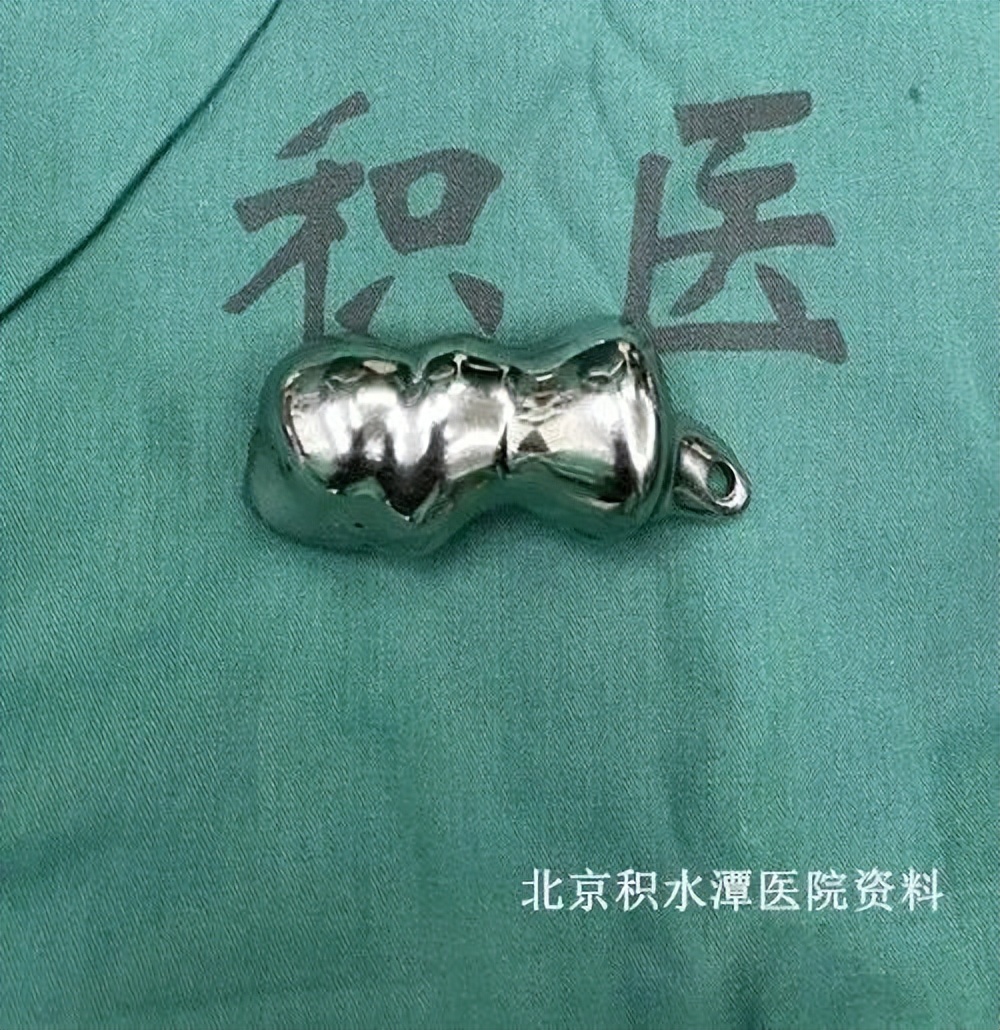 患者是我们最好的老师，也是我们创新的动力——北京积水潭医院蒋协远教授团队完成第二例肘关节表面置换手术