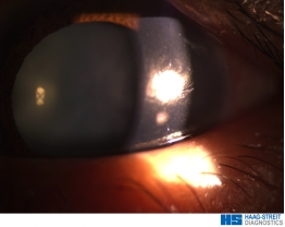 郑州眼科医院全飞秒设备,郑州视光眼科的仪器