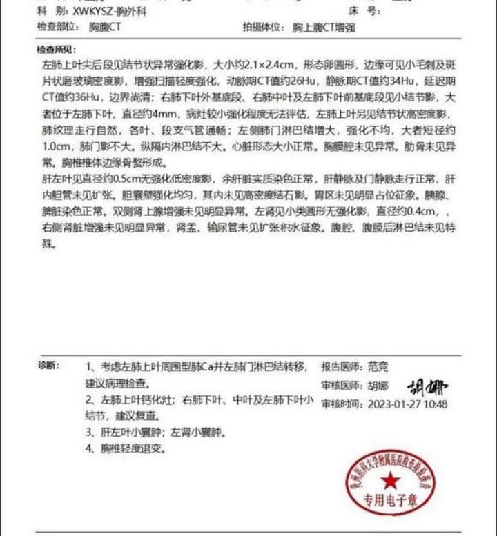 周围型肺癌最好的治疗方法,周围型肺癌早期治愈的可能性大吗