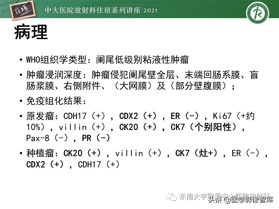 卵巢浆液性肿瘤的肉眼及镜下特征,卵巢原发性粘液性囊腺瘤