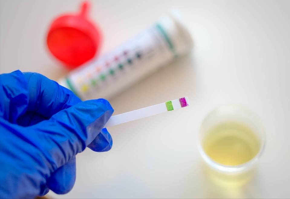 发现尿蛋白要住院吗,发现尿蛋白是肾炎是不是很严重了