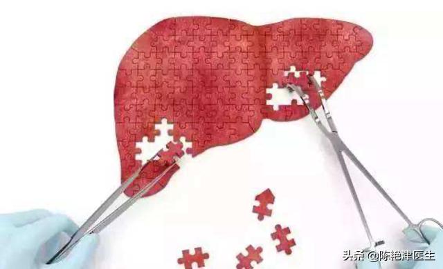 李兰娟谈乙肝什么时候攻破,李兰娟谈乙肝治疗方法