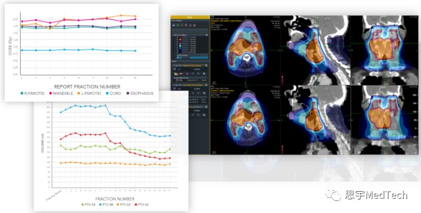 年入31亿！一文了解放疗小巨人安科锐