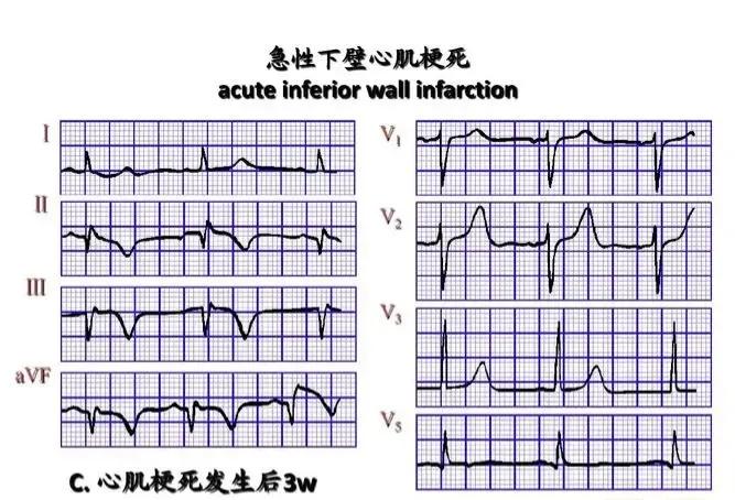 60岁老人老是间歇性牙疼,56岁男老牙疼是咋回事